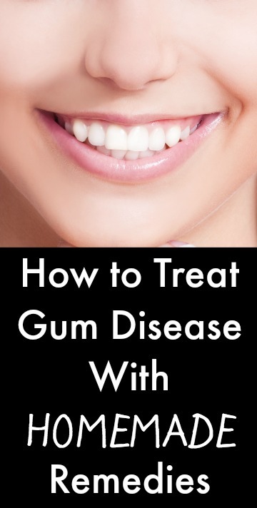 How To Treat Gum Disease With Homemade Remedies