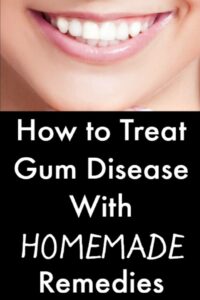 How to Treat Gum Disease Homemade Remedies - https://healthpositiveinfo.com/gum-disease-homemade-remedies.html