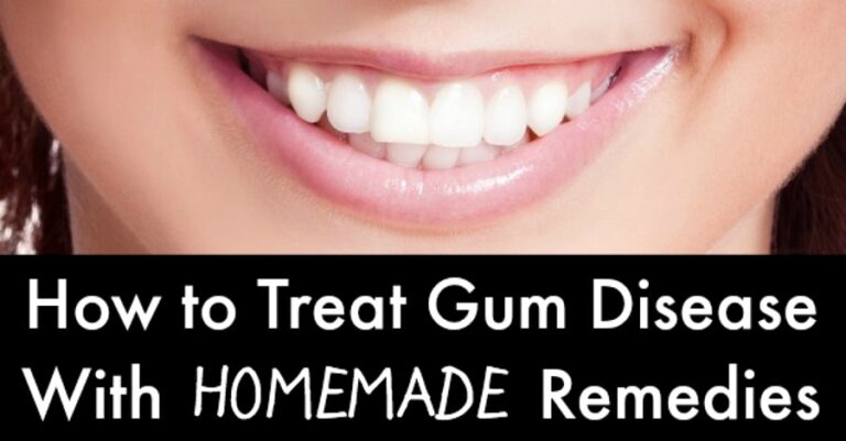 How to Treat Gum Disease Homemade Remedies - https://healthpositiveinfo.com/gum-disease-homemade-remedies.html